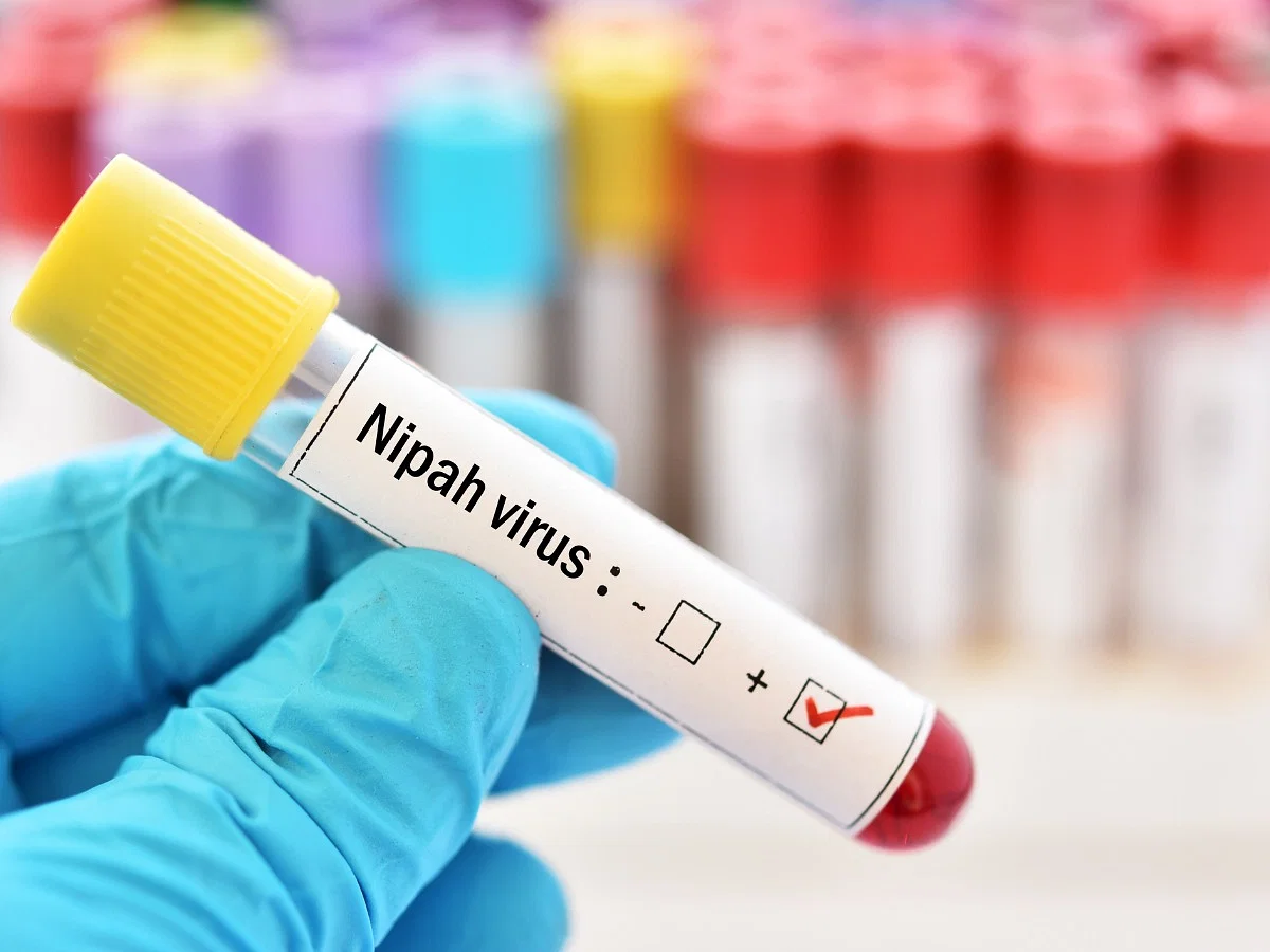 Virus Nipah là gì? Triệu chứng và biện pháp phòng ngừa