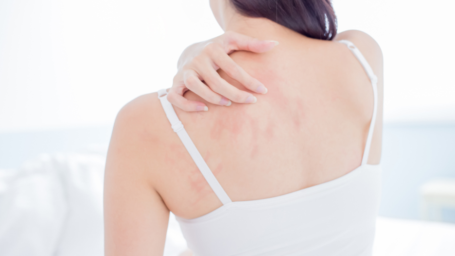 Bệnh vải thiều ở người là gì?
